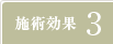 施術効果3